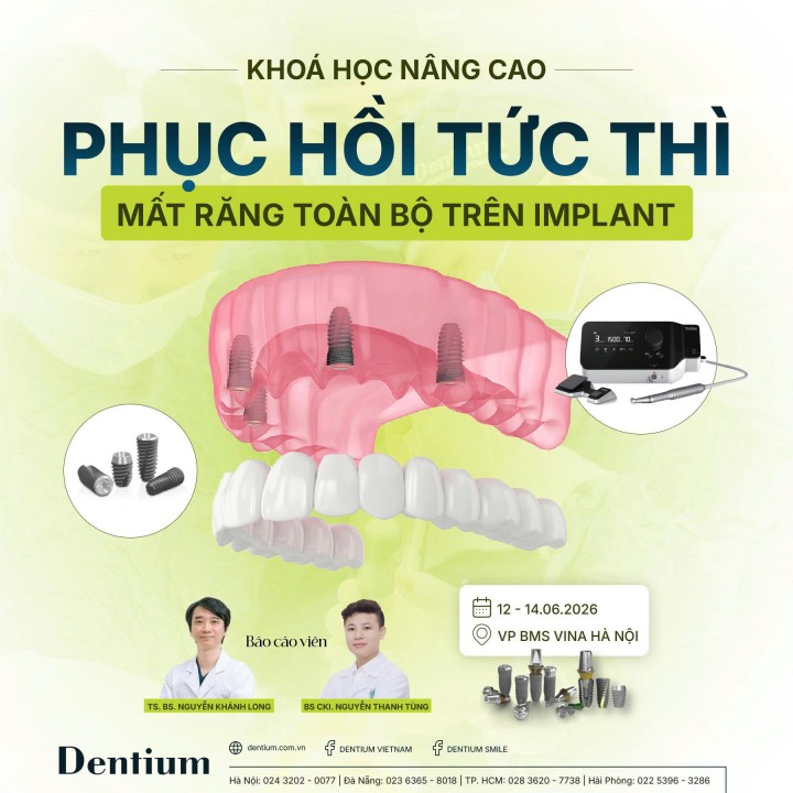 TUYỂN SINH KHÓA HỌC NÂNG CAO: ALL-ON-X - PHỤC HỒI TỨC THÌ TOÀN HÀM TRÊN IMPLANT THÁNG 6 TẠI HÀ NỘI